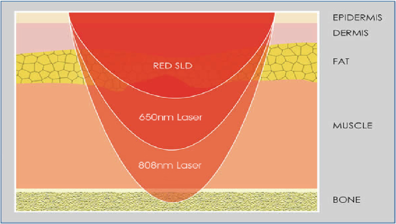 Low Level Laser